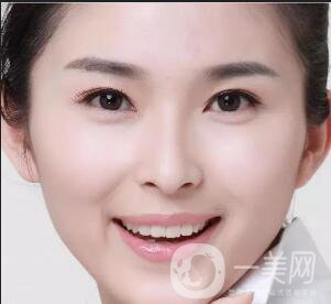 玻尿酸豐蘋果肌術(shù)后多久*果自然