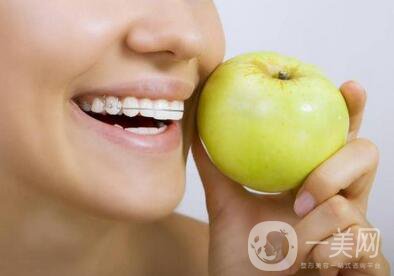 廣東矯正天包地牙價格大概是多少