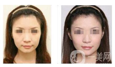 熱瑪吉如何防止魚(yú)尾紋