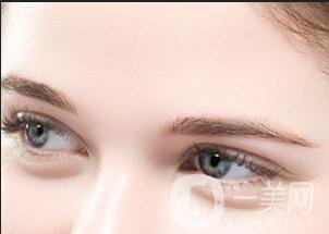 上海*臥蠶手術多少錢,*臥蠶手術注意事項