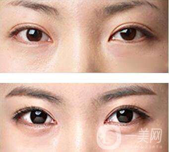 北京豐臥蠶多少錢