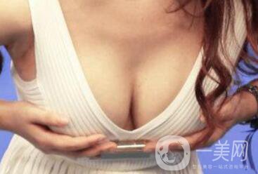 假體豐胸需要恢復(fù)多久