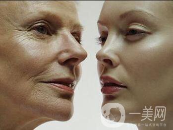 電波拉皮注意事項(xiàng),電波拉皮