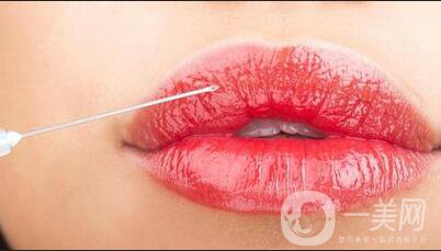 玻尿酸豐唇術(shù)后護(hù)理要注意什么