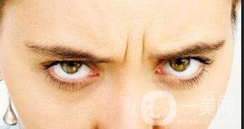 玻尿酸去眉間紋維持時間