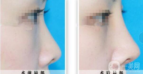 *整形,*整形多少錢,北京*整形多少錢