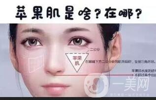 廣東注射玻尿酸豐蘋果肌多少錢,注射玻尿酸豐蘋果肌多少錢