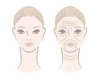 上海去除眉間紋價(jià)格 需要多少錢