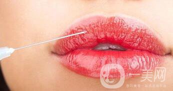 自體脂肪豐唇*果,自體脂肪豐唇