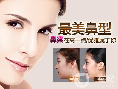 上海肋軟骨隆鼻多少錢(qián),肋軟骨隆鼻多少錢(qián),肋軟骨隆鼻