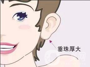 北京注射豐耳垂手術(shù)的價(jià)格一般是多少