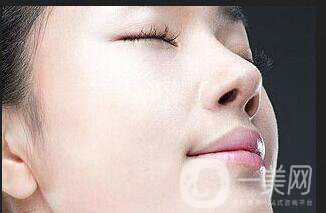 激光去胎記,激光去胎記注意事項(xiàng)