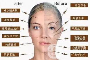 以色列熱瑪吉*果