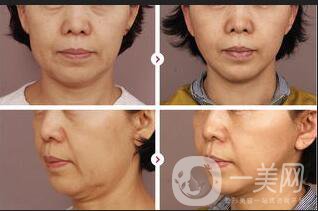 以色列熱瑪吉*果