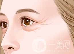 上海自體脂肪去魚尾紋多少錢呢？