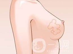 隆胸大概需要多少錢