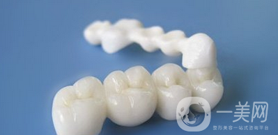 合金烤瓷牙和全瓷牙信息介紹