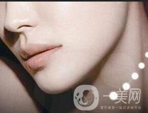 深圳墊下巴費(fèi)用