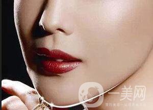 深圳雙下巴吸脂費用