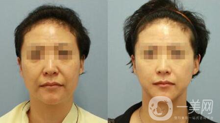 *注意事項及術(shù)后護理工作介紹