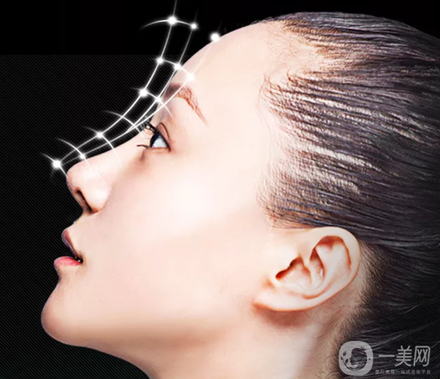 假體隆鼻手術(shù)一般多少錢