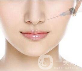 玻尿酸隆鼻多少錢