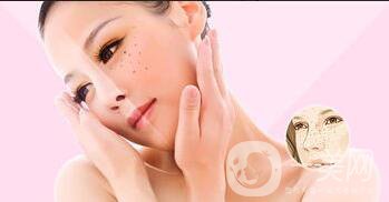 祛斑價(jià)錢,激光祛斑價(jià)格