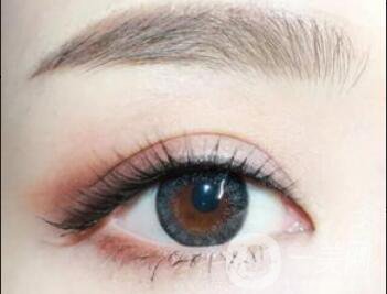 雙眼皮貴不貴,雙眼皮價(jià)格