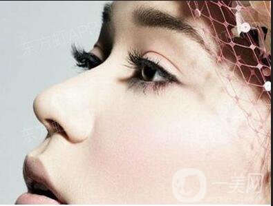 鼻翼縮小手術(shù)價格