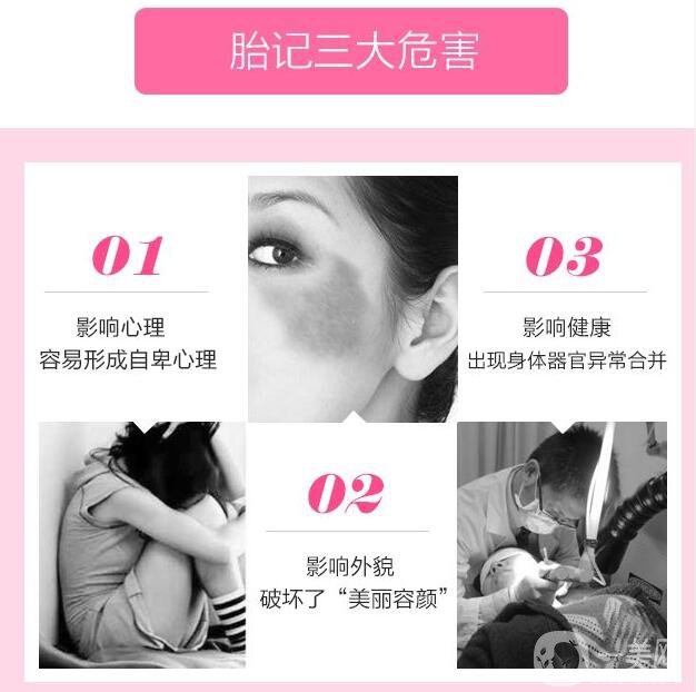 深圳激光去胎記多少錢