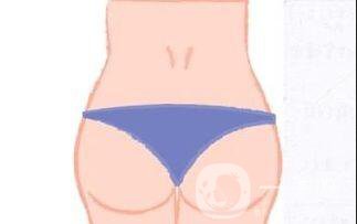 深圳自體脂肪豐臀價(jià)格,自體脂肪豐臀價(jià)格,自體脂肪豐臀