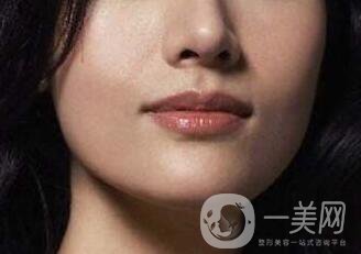 鷹鉤鼻矯正注意事項(xiàng)