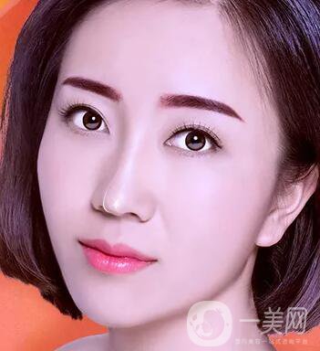 鼻頭縮小術注意事項