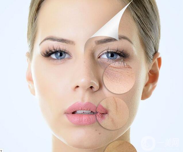 射頻和電波拉皮那個(gè)好