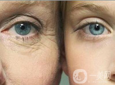 除皺方式 除皺價(jià)格