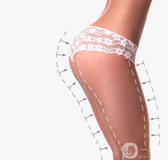 上海自體脂肪填屁股多少錢