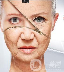 皮膚松弛與褶皺 射頻和電波拉皮信息介紹？