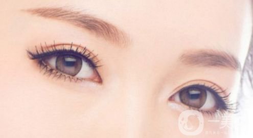 變雙眼皮的*方法,割雙眼皮的方法有哪些