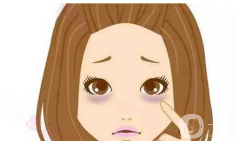 射頻去黑眼圈貴嗎,射頻去黑眼圈*果嗎