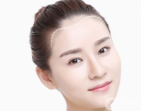 改發(fā)際線價(jià)格是多少？