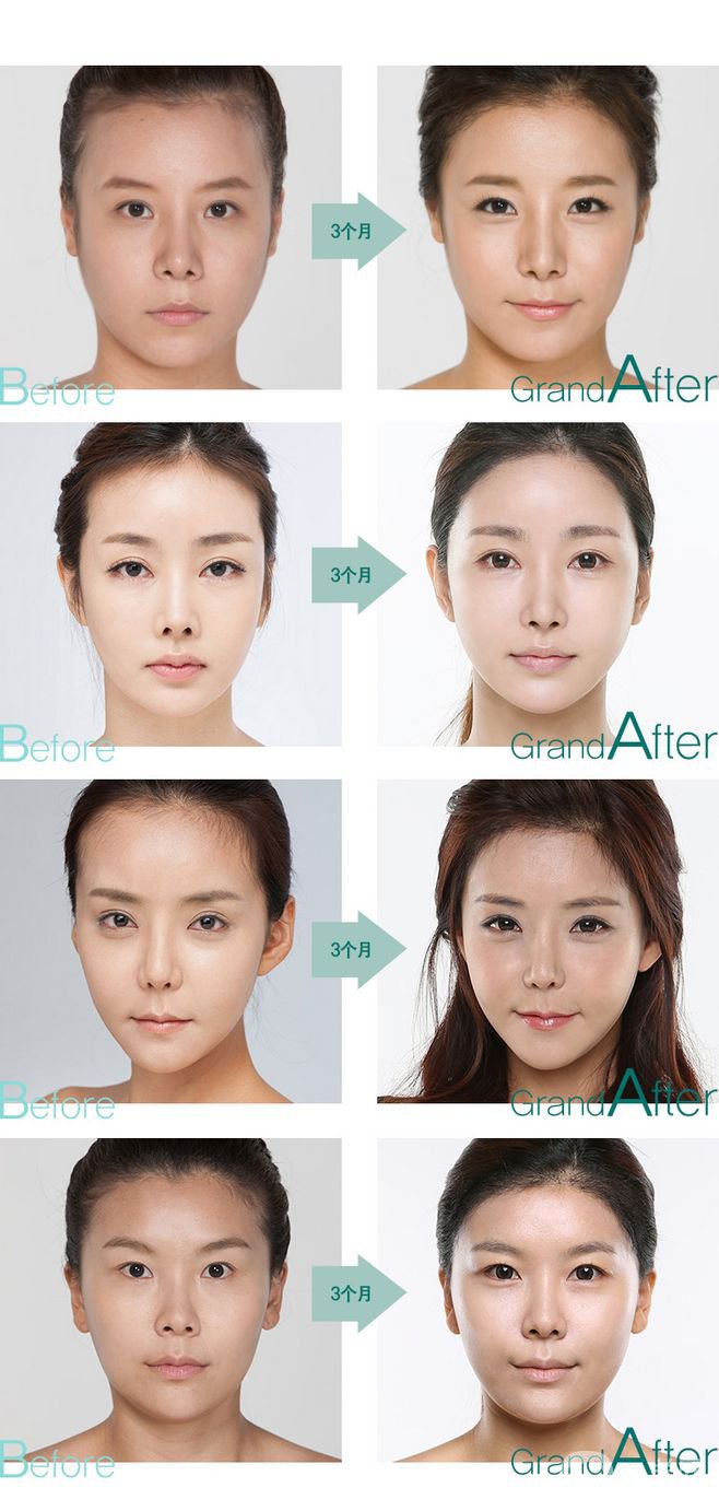 改發(fā)際線價(jià)格是多少？