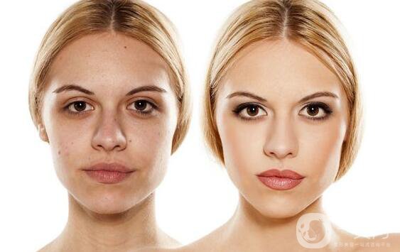 光子嫩膚是什么 價(jià)格多少？