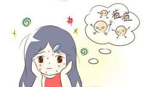 激光祛痘*果怎么樣 激光祛痘好不好