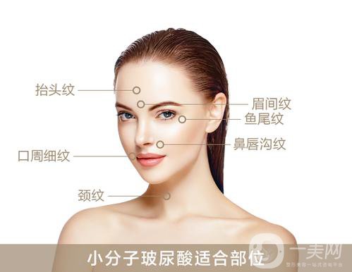 上海瑞蘭玻尿酸價(jià)格？*果怎么樣？