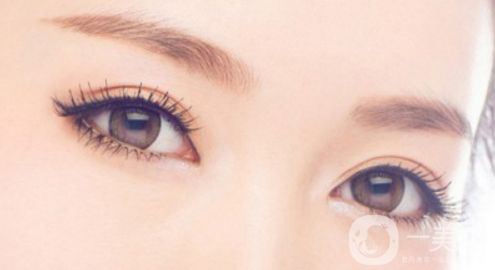 生物焊接雙眼皮多少錢？*果怎么樣？