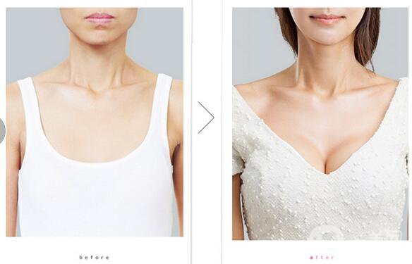 自體脂肪填充注意事項(xiàng)