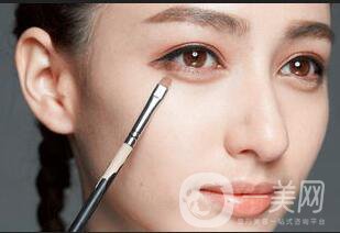 玻尿酸填充臥蠶價格,玻尿酸填充臥蠶風險