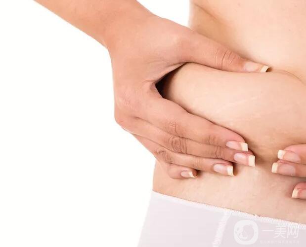 去妊娠紋價(jià)格是多少？