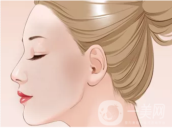 硅膠豐太陽穴貴嗎 硅膠豐太陽穴價(jià)格