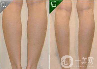 打*價錢 打*有用嗎